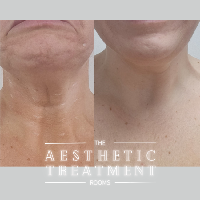 The Aesthetic Treatment Rooms, work photo 6 of 6