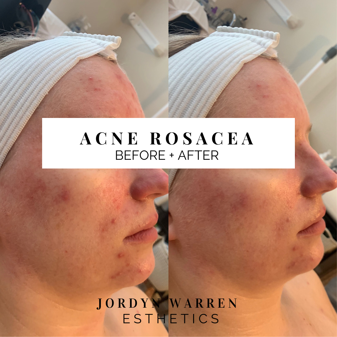 Jordyn Warren Esthetics