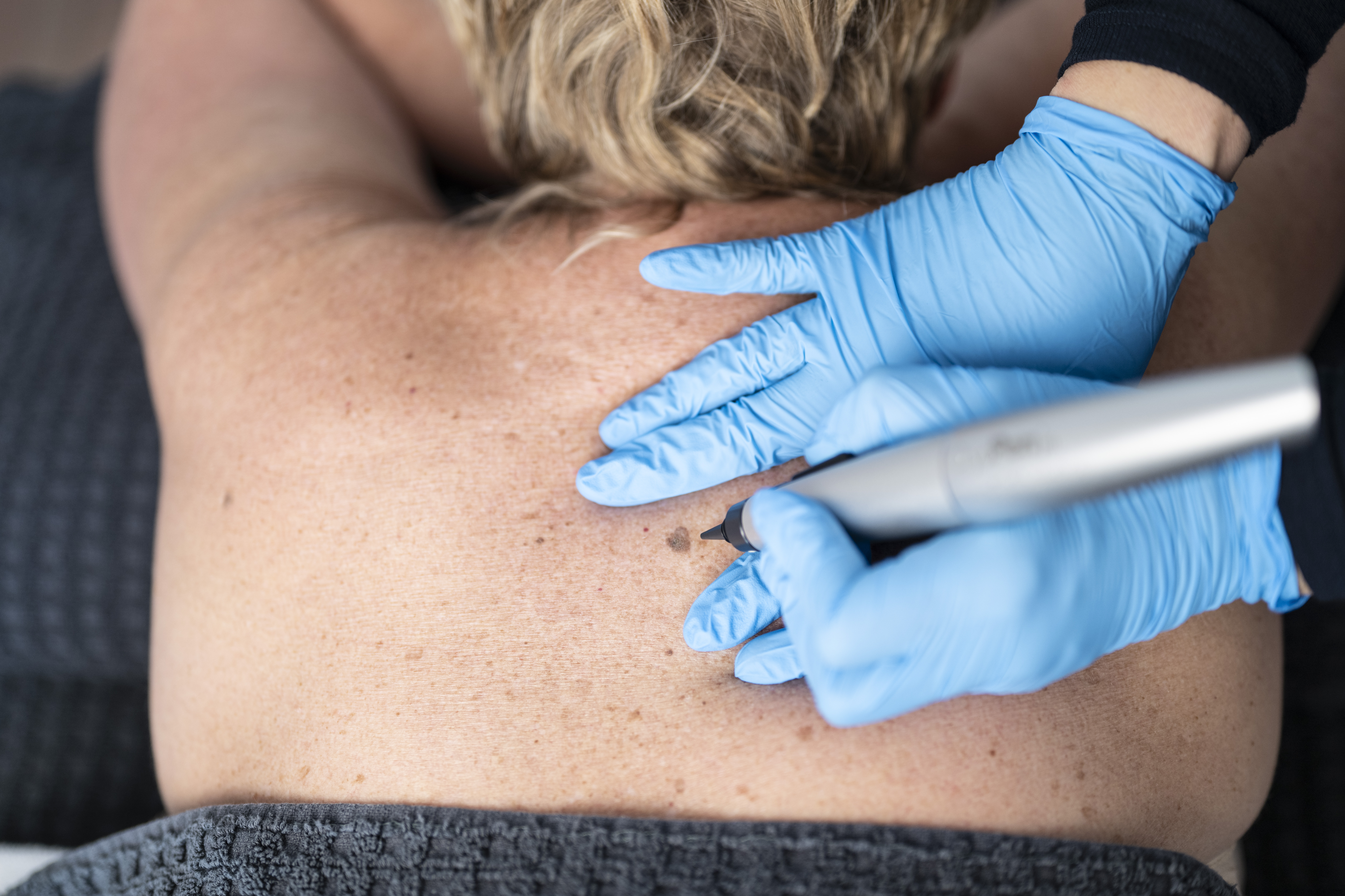 Advanced Electrolysis