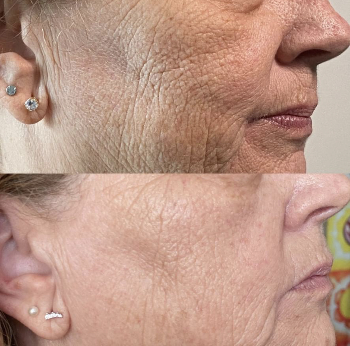 Jordyn Warren Esthetics