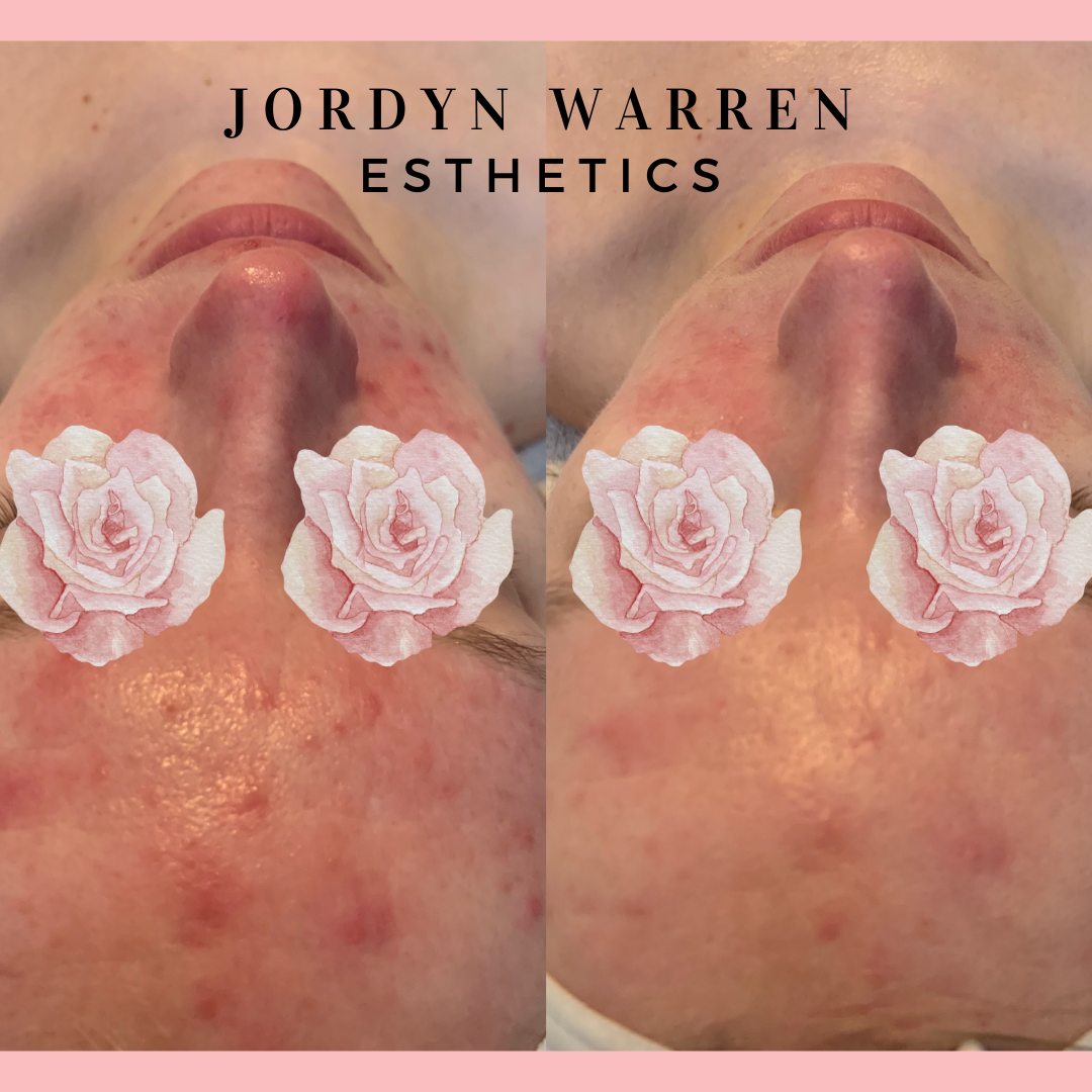 Jordyn Warren Esthetics